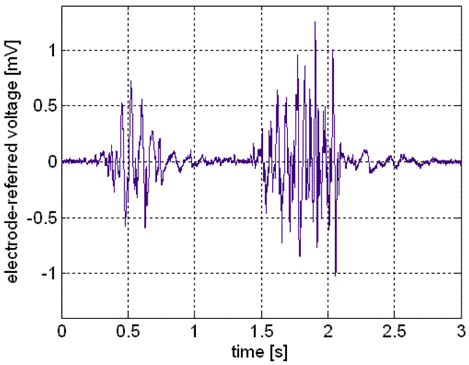 emg.gif