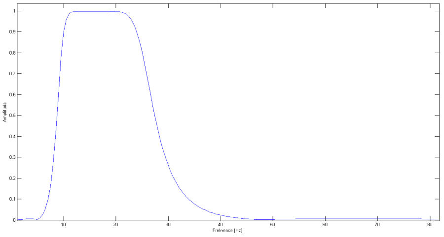 ekg_filt.png