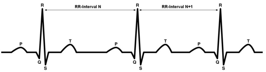 rr-interval.png